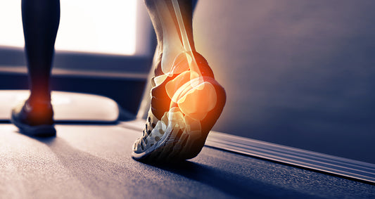 Banish Inflammation, Naturally